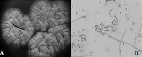 Colonies Of Streptomyces Sp S72 In Isp2 Solid Media A Aerial Hyphea