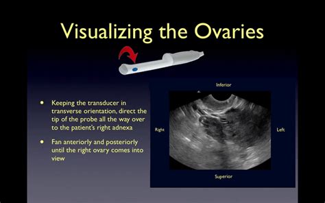 Transvaginal Ultrasound on Make a GIF