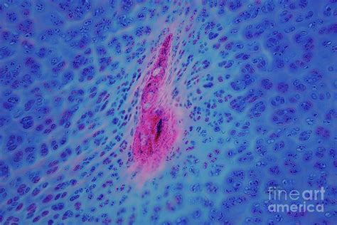 Human Hyaline Cartilage Photograph By Choksawatdikorn Science Photo