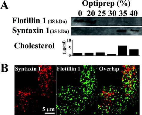 Site of Docking and Fusion of Insulin Secretory Granules in Live MIN6 β