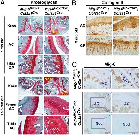 Cartilage Specific Deletion Of Mig 6 Results In Osteoarthritis Like