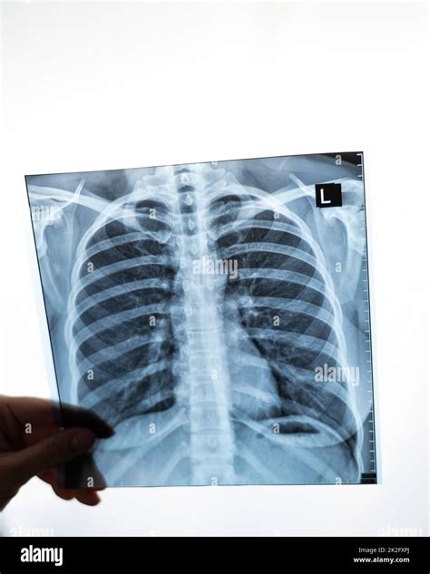 Doctor showing x-ray of patient's lungs Stock Photo - Alamy