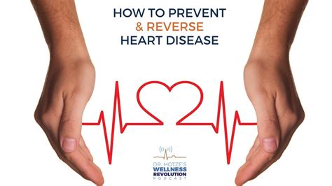 How To Prevent And Reverse Heart Disease Youtube