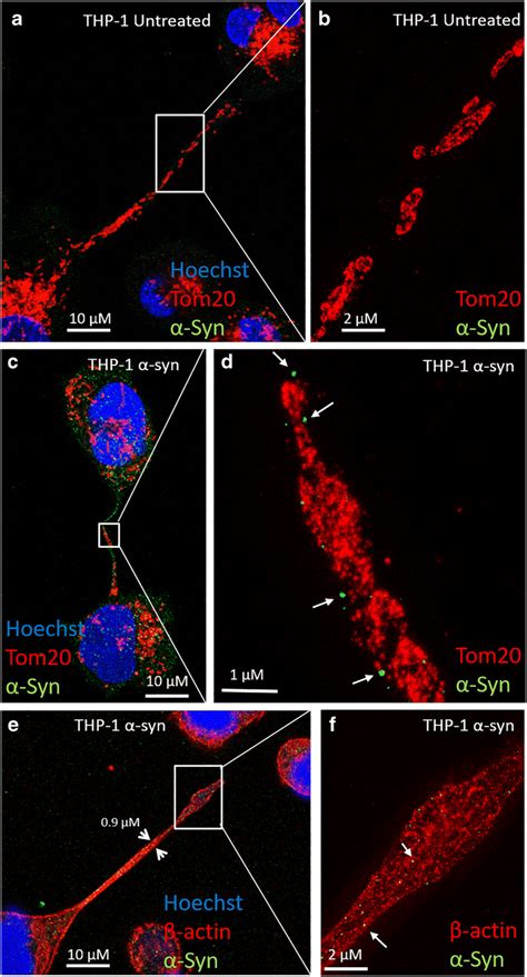 Immunofluorescence Of Differentiated Thp Cell Reveals Tnt Like