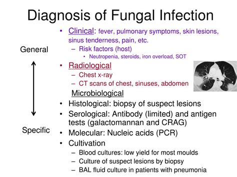 What is fungal infection in skin: Fungal infections: Symptoms, types, and treatment