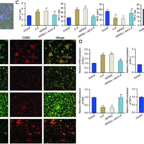 Hdpscs Regulate Macrophage Polarization Through Il 6gp130stat3