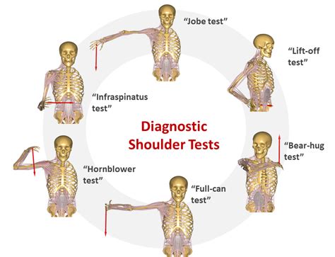 Shoulder Rotator Cuff Tests Nbkomputer