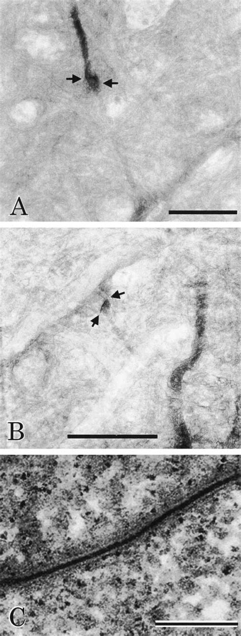 Electron Micrographs Showing The Dendrodendritic Gap Junctions Between