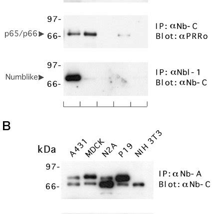 Numb Isoforms Are Differentially Expressed In Mouse Tissues And Cell