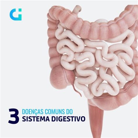 3 DOENÇAS COMUNS DO SISTEMA DIGESTIVO Giovanardi