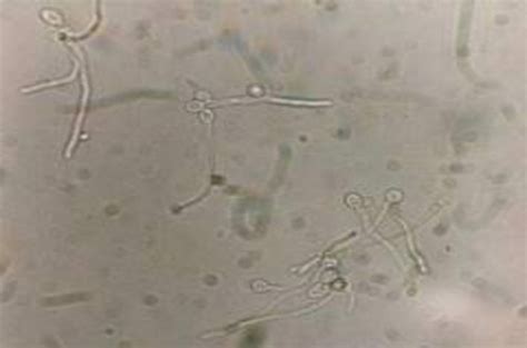 Figure 1 From Comparison Of Germ Tube Production By Candida Albicans In Various Media Semantic