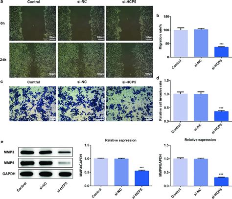 LncRNA HCP5 Silencing Inhibits The Migratory And Invasive Abilities Of