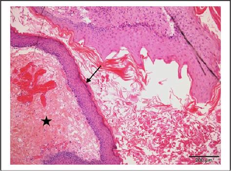 Nasal Dermoid Cyst With Intracranial Extension In A Cat Semantic Scholar