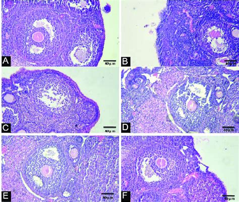 Light Microscopy Of Ovarian Tissue In Different Groups Hande Normal