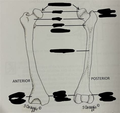 Femur Anterior And Posterior Views Diagram Quizlet