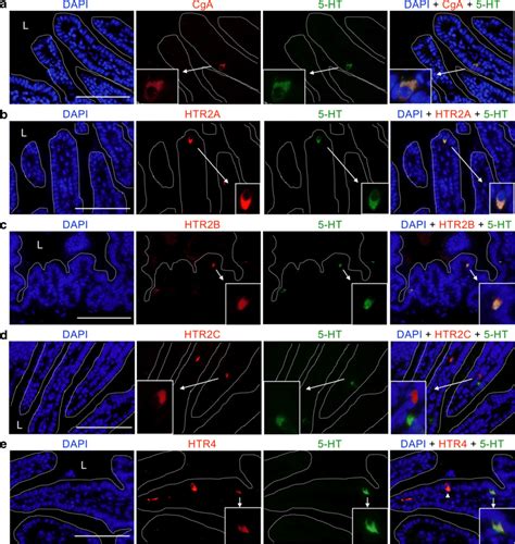 Immunofluorescence Staining For Cga Hydroxytryptamine Ht And