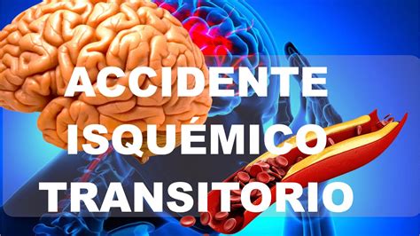 Accidente Isqu Mico Transitorio Ait Youtube