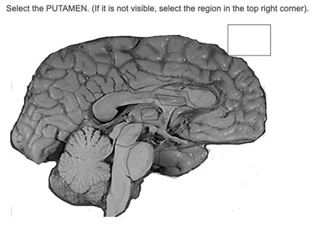 Solved Select the PUTAMEN. (If it is not visible, select the | Chegg.com