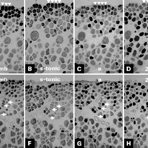 Immunoperoxidase Staining Of Semi Serial Sections Of The Rabbit Sr At