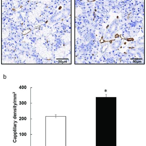 Capillaries In Rat Submandibular Glands Are Increased After 5 Days Of