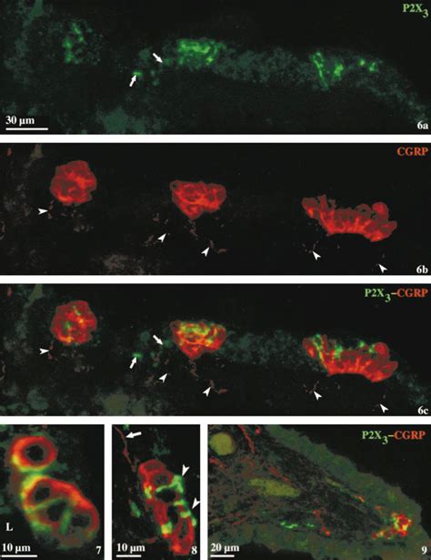 Show Immunocytochemical Double Staining For P2X 3 Receptors Green FITC