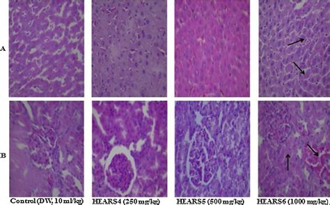 A Section Of Subacute Treated Female Rat Liver Tissue Show Parallel