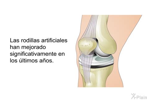 PatEdu Reemplazo De Rodilla Fisioterapia