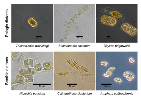 Diatoms Algae