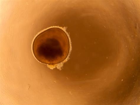 mini eyes  researchers understand blindness  rare condition