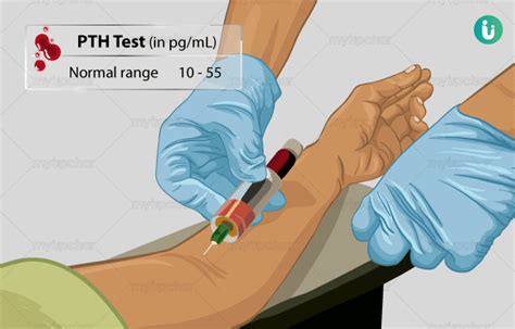 What Is The Normal Range For A Parathyroid Hormone (PTH), 49% OFF