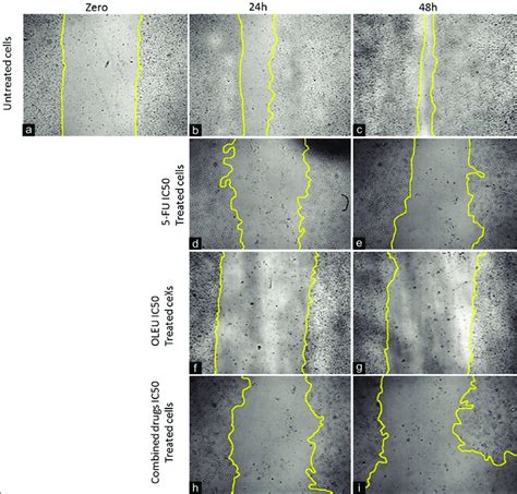 Qualitative analysis of cell migration assay on HNO-97 cells | Download ...