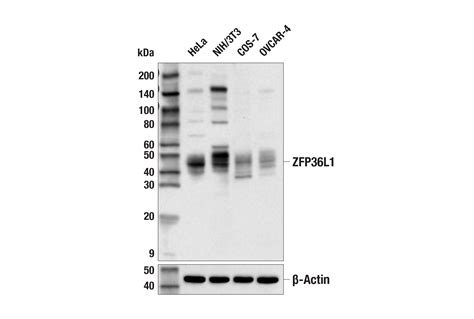 Zfp L E L S Rabbit Mab Cell Signaling Technology