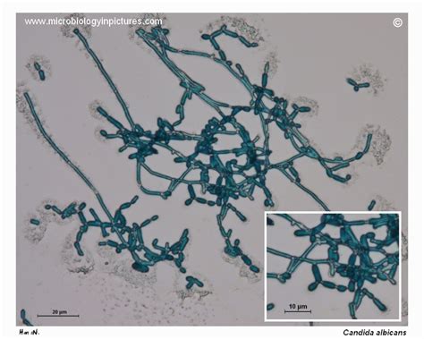 Hyphae and pseudohyphae of Candida albicans. Filamentous growth of ...