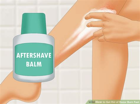 How To Get Rid Of Razor Burn Fast