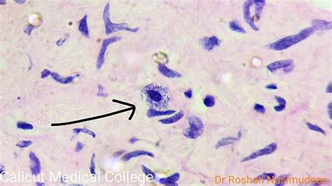 Mast Cells Histology