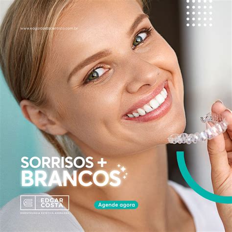 Clareamento Dental Tudo O Que Vc Precisa Saber Edgar Costa Dentista