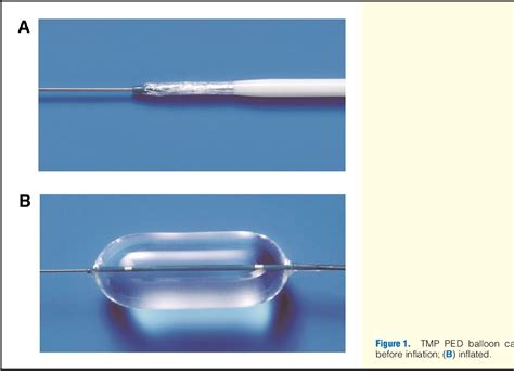 Figure 1 From Impact Of Novel Balloon Catheter On Static Balloon Atrial