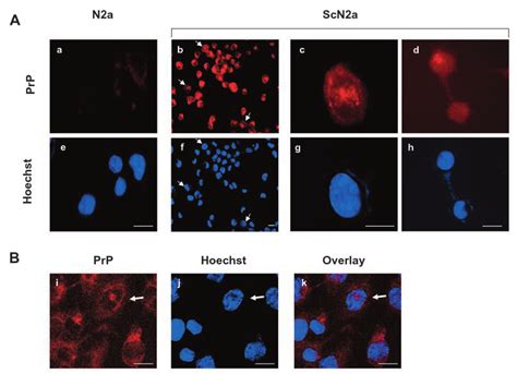 Nuclear Localization Of PrP Sc In Prion Infected N2a Cells By