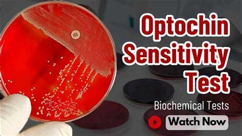 Optochin Susceptibility Test Streptococcus Pneumoniae Identification