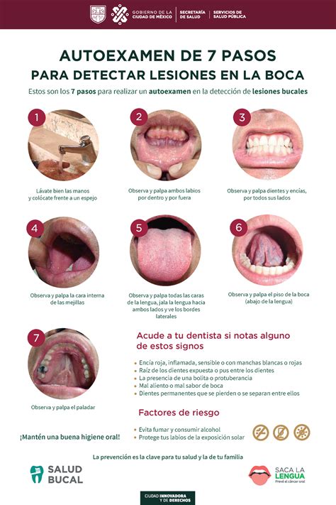 Cartel Autoexamen Saca La Lengua Estos Son Los Pasos Para Realizar