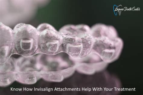 A Comprehensive Guide To Invisalign Attachments Invisalign Attachments