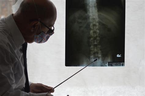 What is Spinal Fusion? | Advanced Surgery Center