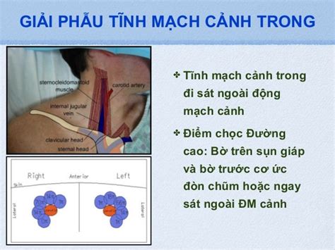 dat catheter tinh mach trung tam