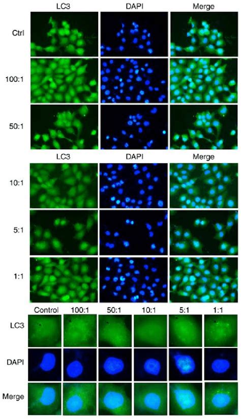 Confocal Microscopy Observation Of A549 Cells Infected With K