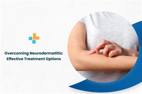 Overcoming Neurodermatitis Effective Treatment Options By Ayu Health