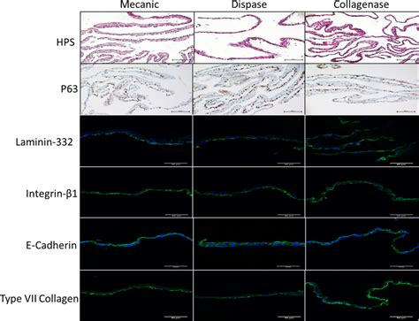 Western Blot Analysis Of Levels Of Laminin And Adhesion Proteins In