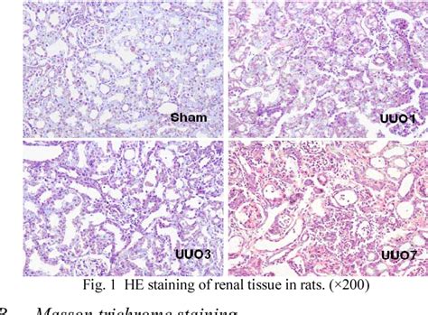 Figure 1 From The Effects Of Urotensin II And Its Receptor In Rat Renal