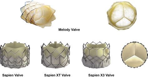 The Risk Of Infective Endocarditis Following Interventional Pulmonary