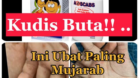 Kudis Buta Ubat Paling Mujarab Youtube