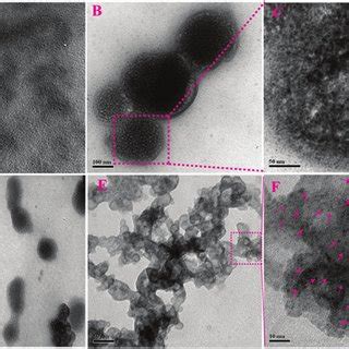 Representative Tem Images Depicting The Au Nc Zn Po Growth